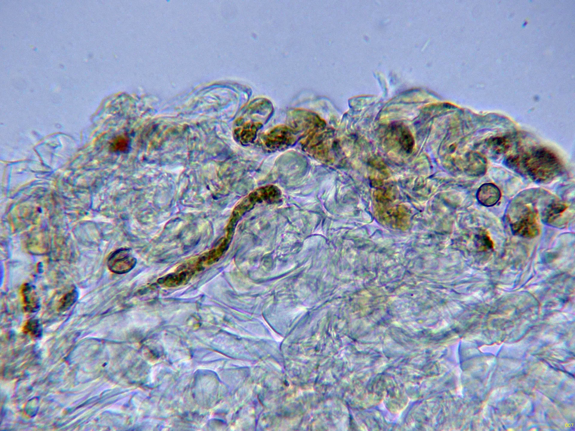 10 - Suprapellis agua-007